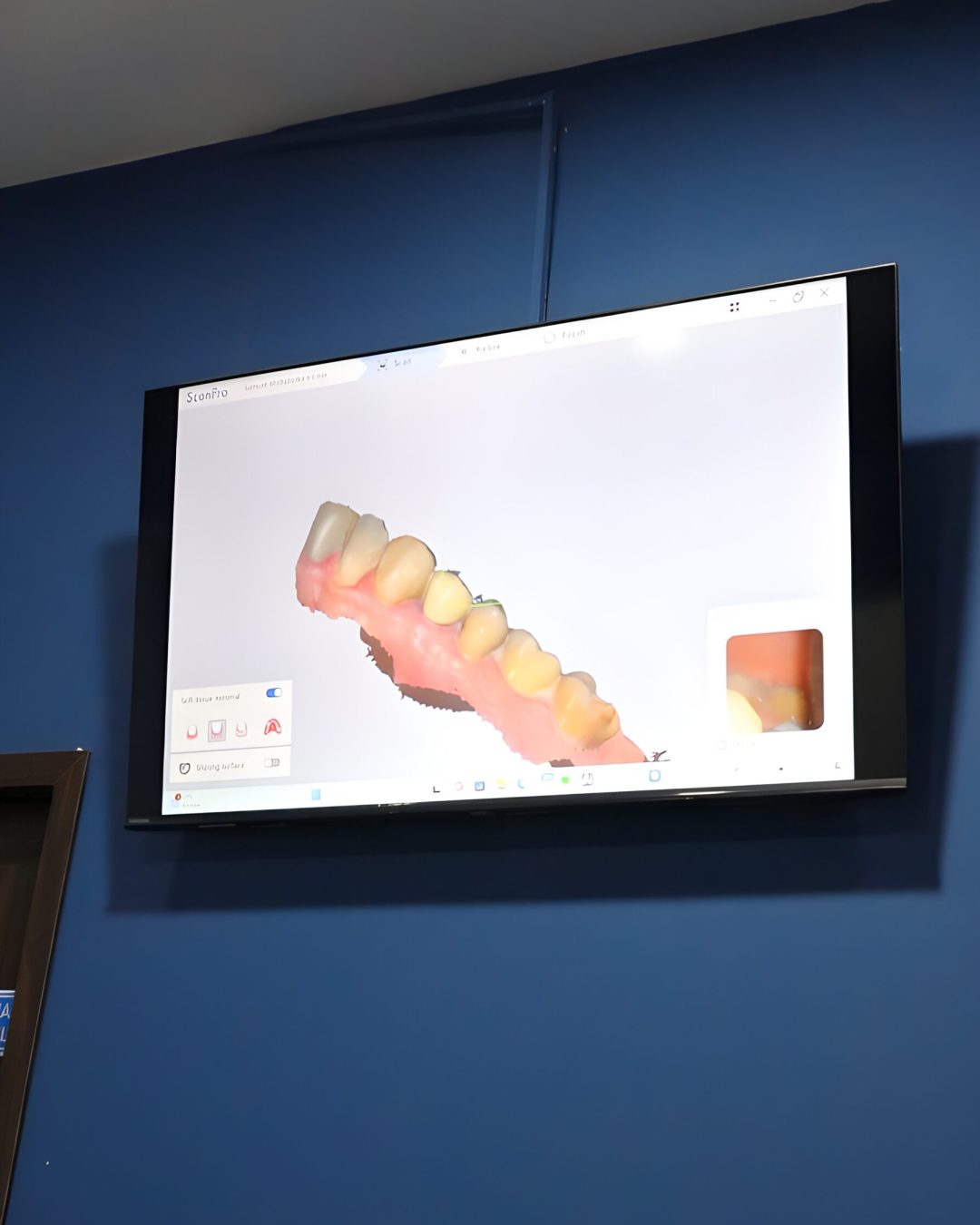 3D Scanner Gigi 3D Scanner Gigi